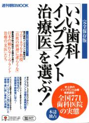 いい歯科インプラント治療医を選ぶ